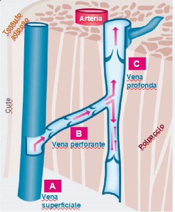 Insufficienza venosa e uso delle calze elastiche